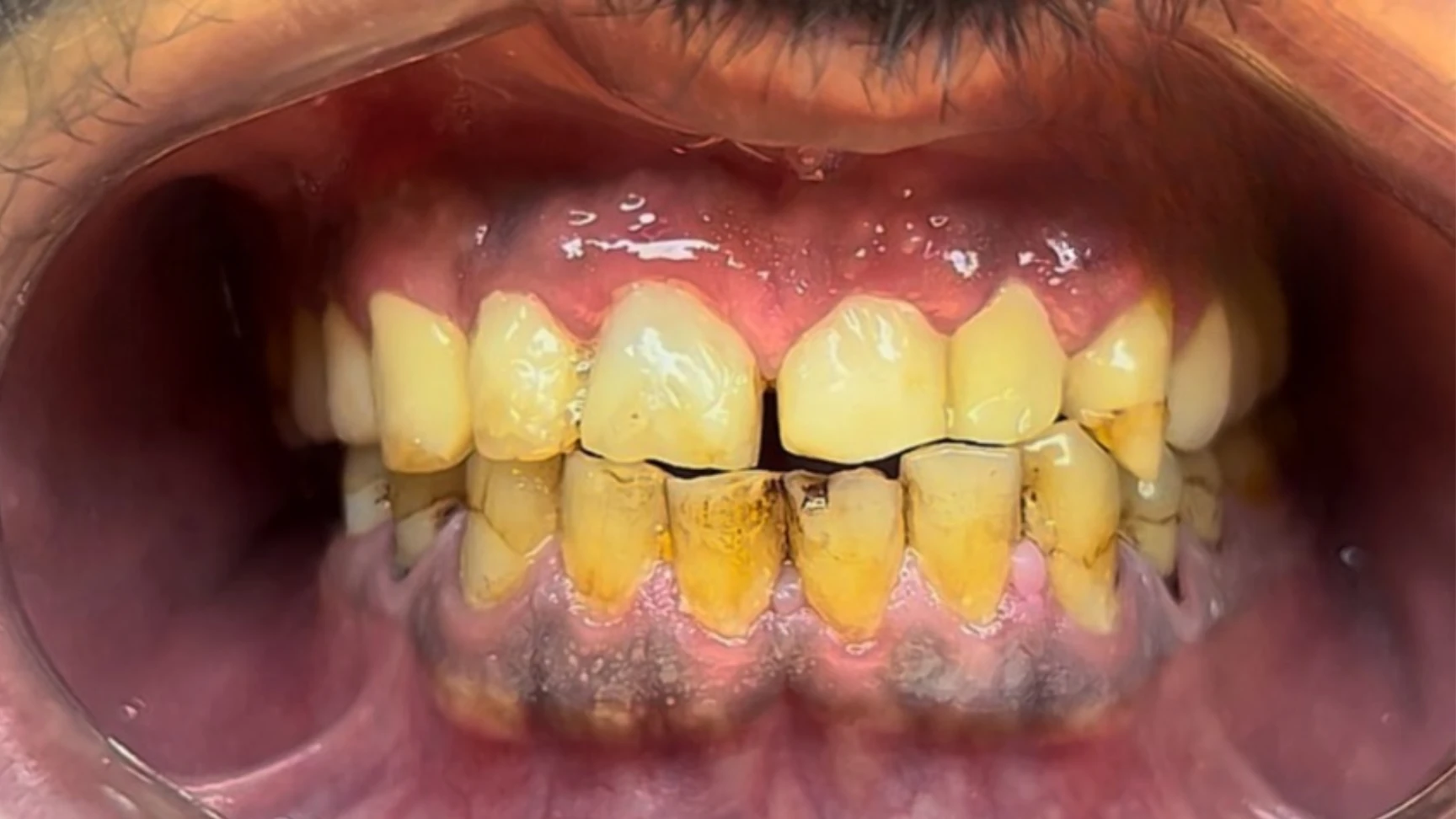 Before image
